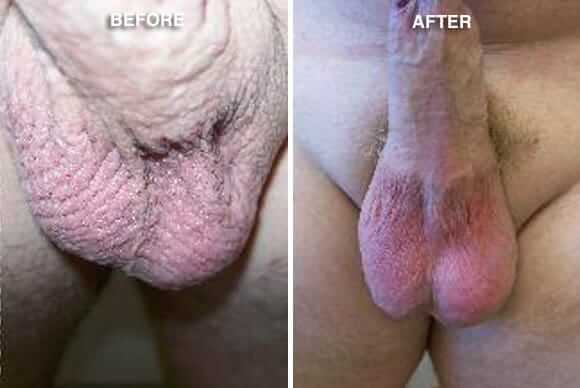Before and After