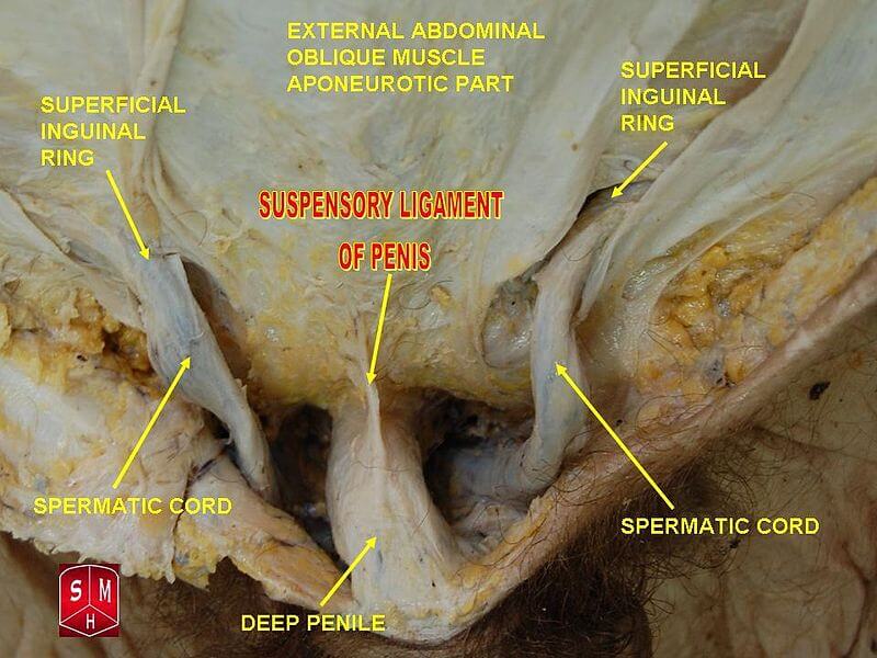 Suspensory Ligament Release for Penile Lengthening