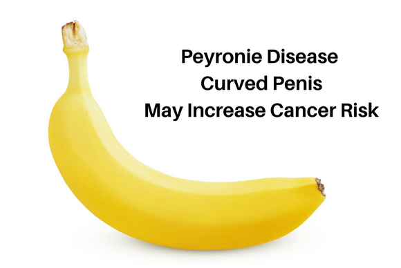 Peyronie Disease Curved Penis May Increase Cancer Risk