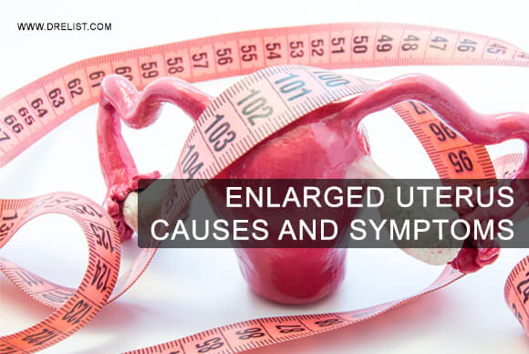 Enlarged Uterus – Causes And Symptoms