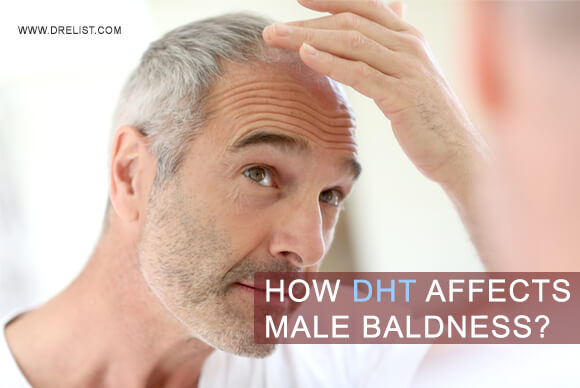 How Does Dihydrotestosterone (DHT) Affect Male Baldness?