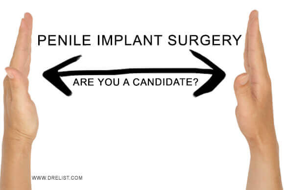Penile Implant Surgery – Are You A Candidate?