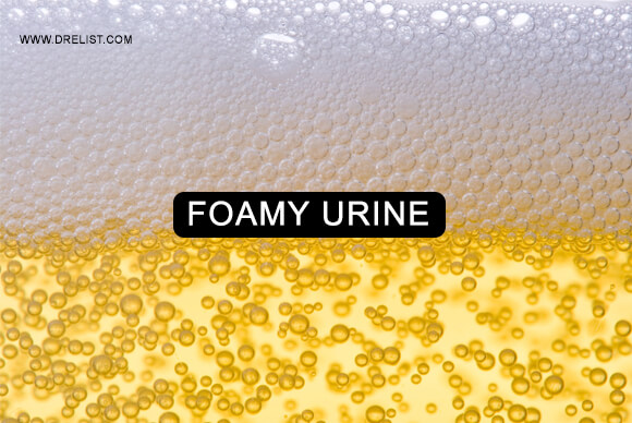 Foamy Urine