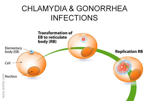 Chlamydia and Gonorrhea Infections
