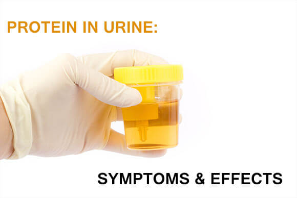 Protein in Urine: Symptoms & Effects