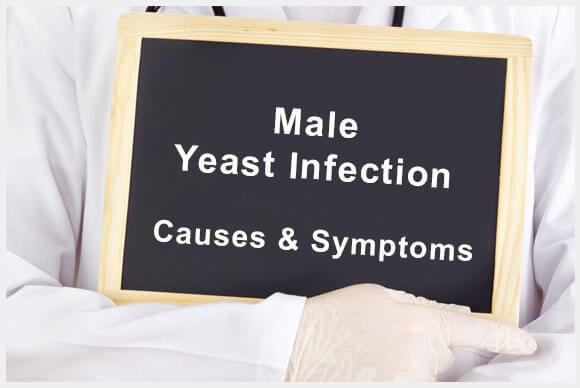 Male Yeast Infection Causes & Symptoms