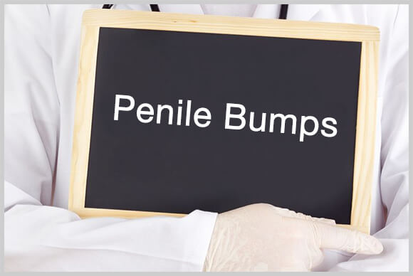 Penile Bumps | What Are Penile Bumps? (Penile Growth)