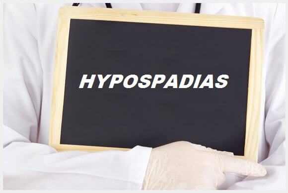 Male Genital Deformities: Hypospadias