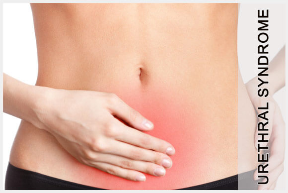 Urethral Syndrome
