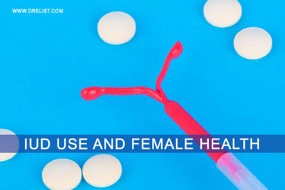 IUD Use And Female Health