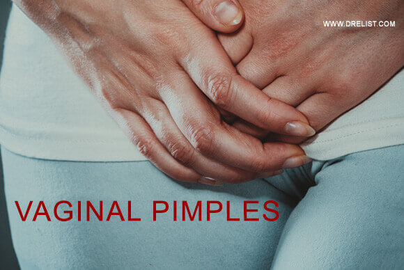 Vaginal Pimples – What Should You Know About It?